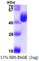 L-asparaginase I / ansA Protein