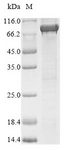 LDC / Lysine Decarboxylase Protein - (Tris-Glycine gel) Discontinuous SDS-PAGE (reduced) with 5% enrichment gel and 15% separation gel.