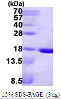 ndk Protein