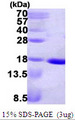 ndk Protein