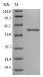 Outer Membrane Protein C Protein - (Tris-Glycine gel) Discontinuous SDS-PAGE (reduced) with 5% enrichment gel and 15% separation gel.