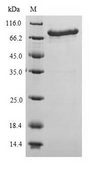 Polymyxin resistance protein MCR-1 Protein - (Tris-Glycine gel) Discontinuous SDS-PAGE (reduced) with 5% enrichment gel and 15% separation gel.