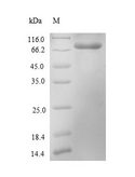 Polymyxin resistance protein MCR-1 Protein - (Tris-Glycine gel) Discontinuous SDS-PAGE (reduced) with 5% enrichment gel and 15% separation gel.