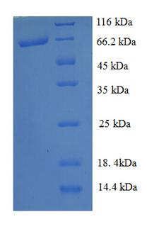 poxB Protein