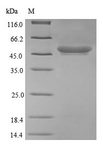 Protease 7 Protein - (Tris-Glycine gel) Discontinuous SDS-PAGE (reduced) with 5% enrichment gel and 15% separation gel.