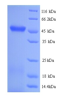 rtcB / RNA-Splicing Ligase Protein