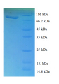 TKT / Transketolase Protein