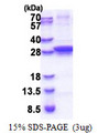 UNG / Uracil DNA Glycosylase Protein
