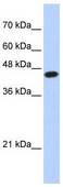 E2F1 Antibody - Western analysis of 293T cell lysate.  This image was taken for the unconjugated form of this product. Other forms have not been tested.