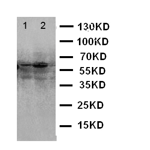 E2F1 Antibody - WB of E2F1 antibody. Lane 1: HELA Cell Lysate. Lane 2: MCF-7 Cell Lysate.