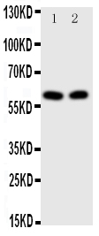 E2F1 Antibody - Anti-E2F1 antibody, Western blotting All lanes: Anti E2F1 at 0.5ug/ml Lane 1: HELA Whole Cell Lysate at 40ug Lane 2: MCF-7 Whole Cell Lysate at 40ug Predicted bind size: 47KD Observed bind size: 60KD
