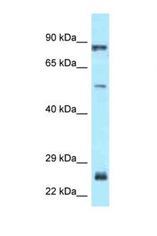 E2F1 Antibody - E2F1 antibody Western blot of Fetal Lung lysate. Antibody concentration 1 ug/ml.  This image was taken for the unconjugated form of this product. Other forms have not been tested.
