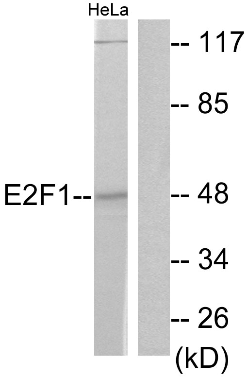 E2F1 Antibody - Western blot analysis of lysates from HeLa cells, treated with Etoposide 25uM 24h, using E2F1 Antibody. The lane on the right is blocked with the synthesized peptide.
