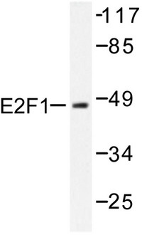 E2F1 Antibody - Western blot of E2F1 (D426) pAb in extracts from HeLa cells treated with Etoposide 25uM 24h.