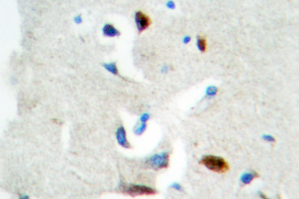 E2F1 Antibody - IHC of E2F1 (D426) pAb in paraffin-embedded human brain tissue.