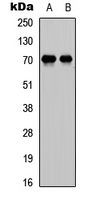 E2F1 Antibody - Western blot analysis of E2F1 expression in MCF7 (A); A549 (B) whole cell lysates.