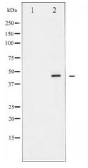 E2F1 Antibody - Western blot of E2F1 expression in Etoposide treated HeLa whole cell lysates,The lane on the left is treated with the antigen-specific peptide.