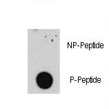 E2F1 Antibody - Dot blot of anti-E2F1-pS332 antibody (RB08110) on nitrocellulose membrane. 50ng of Phospho-peptide or Non Phospho-peptide per dot were adsorbed. Antibody working concentrations are 0.5ug per ml.