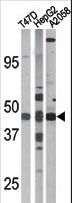 E2F1 Antibody - The anti-Phospho-E2F1-S337 antibody is used in Western blot to detect Phospho-E2F1-S337 in T47D(left), HepG2(middle), and A2058(right) tissue lysates