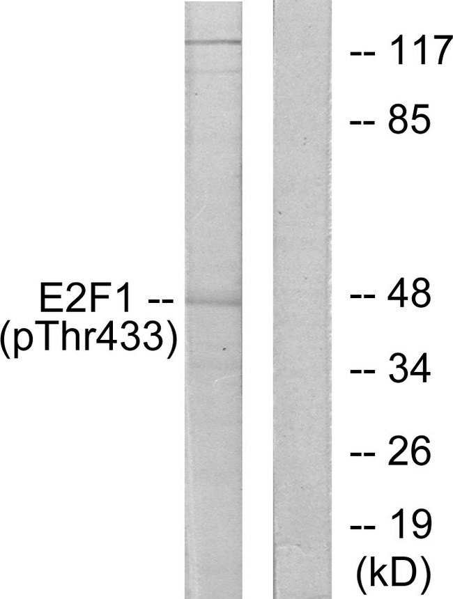 E2F1 Antibody - Western blot analysis of lysates from HeLa cells treated with Etoposide 25uM 24h, using E2F1 (Phospho-Thr433) Antibody. The lane on the right is blocked with the phospho peptide.