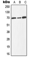 E2F1 Antibody - Western blot analysis of E2F1 (pT433) expression in Jurkat colchicine-treated (A); mouse spleen (B); PC12 colchicine-treated (C) whole cell lysates.