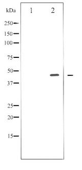 E2F1 Antibody - Western blot of E2F1 phosphorylation expression in Etoposide treated HeLa whole cell lysates,The lane on the left is treated with the antigen-specific peptide.