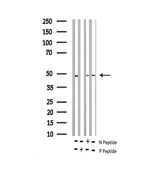 E2F1 Antibody - Western blot analysis of extracts of various tissue sample using PDLIM1 antibody.