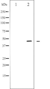 E2F1 Antibody - Western blot analysis of E2F1 phosphorylation expression in Etoposide treated HeLa whole cells lysates. The lane on the left is treated with the antigen-specific peptide.