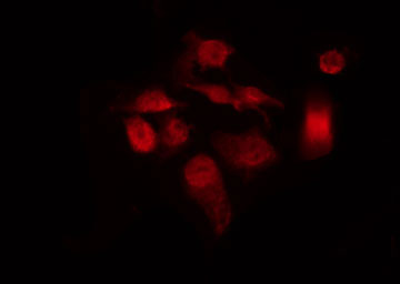 E2F1 Antibody - Staining HeLa cells by IF/ICC. The samples were fixed with PFA and permeabilized in 0.1% Triton X-100, then blocked in 10% serum for 45 min at 25°C. The primary antibody was diluted at 1:200 and incubated with the sample for 1 hour at 37°C. An Alexa Fluor 594 conjugated goat anti-rabbit IgG (H+L) Ab, diluted at 1/600, was used as the secondary antibody.