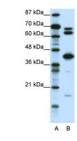 E2F2 Antibody - E2F2 antibody Western blot of Jurkat lysate. This image was taken for the unconjugated form of this product. Other forms have not been tested.