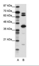 E2F2 Antibody - A: Marker, B: Jurkat Cell Lysate.  This image was taken for the unconjugated form of this product. Other forms have not been tested.