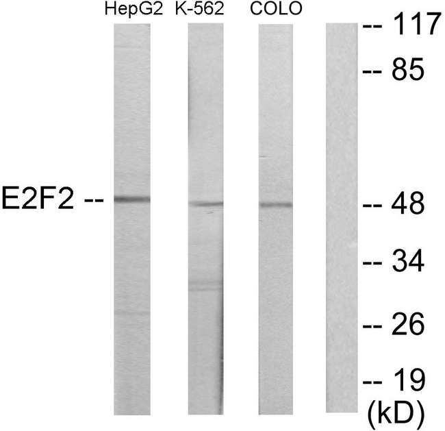 E2F2 Antibody - Western blot analysis of lysates from HepG2, K562, and COLO205 cells, using E2F2 Antibody. The lane on the right is blocked with the synthesized peptide.