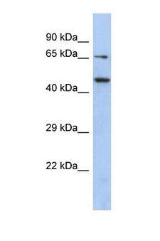 E2F2 Antibody - Western blot of Human PANC1. E2F2 antibody dilution 1.0 ug/ml.  This image was taken for the unconjugated form of this product. Other forms have not been tested.