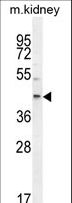 E2F2 Antibody - E2F2 Antibody western blot of mouse kidney tissue lysates (35 ug/lane). The E2F2 antibody detected the E2F2 protein (arrow).