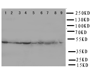 E2F2 Antibody - WB of E2F2 antibody. Lane 1: Rat Lung Tissue Lysate. Lane 2: Rat Heart Tissue Lysate. Lane 3: Rat Brain Tissue Lysate . Lane 4: Rat Kidney Tissue Lysate. Lane 5: HELA Cell Lysate. Lane 6: COLO320 Cell Lysate. Lane 7: A549 Cell Lysate. Lane 8: MCF-7 Cell Lysate. Lane 9: SMMC Cell Lysate.