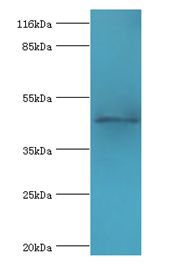 E2F2 Antibody - Western blot. All lanes: E2F2 antibody at 2 ug/ml+293T whole cell lysate. Secondary antibody: Goat polyclonal to rabbit at 1:10000 dilution. Predicted band size: 48 kDa. Observed band size: 48 kDa.  This image was taken for the unconjugated form of this product. Other forms have not been tested.