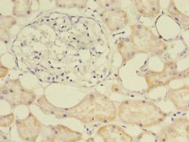 E2F2 Antibody - Immunohistochemistry of paraffin-embedded human kidney using antibody at 1:100 dilution.  This image was taken for the unconjugated form of this product. Other forms have not been tested.