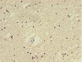 E2F2 Antibody - Immunohistochemistry of paraffin-embedded human brain tissue using antibody at 1:100 dilution.  This image was taken for the unconjugated form of this product. Other forms have not been tested.