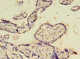 E2F2 Antibody - Immunohistochemistry of paraffin-embedded human placenta tissue using antibody at 1:100 dilution.  This image was taken for the unconjugated form of this product. Other forms have not been tested.