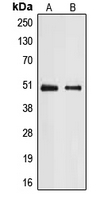 E2F2 Antibody - Western blot analysis of E2F2 expression in A431 (A); Jurkat (B) whole cell lysates.