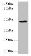 E2F2 Antibody - Western blot All lanes: E2F2 antibody at 2µg/ml + 293T whole cell lysate Secondary Goat polyclonal to rabbit IgG at 1/10000 dilution Predicted band size: 48 kDa Observed band size: 48 kDa
