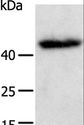 E2F2 Antibody - Western blot analysis of A549 cell, using E2F2 Polyclonal Antibody at dilution of 1:600.