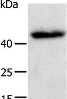 E2F2 Antibody - Western blot analysis of A549 cell, using E2F2 Polyclonal Antibody at dilution of 1:600.