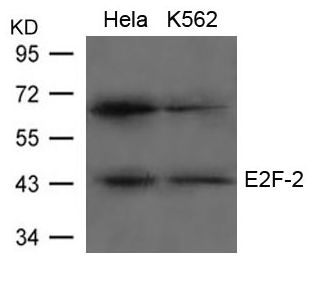 E2F2 Antibody - Western blot of extracts from HeLa and K562 cells using E2F-2 Antibody