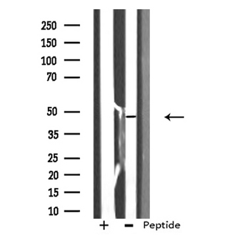 E2F2 Antibody - Western blot analysis of extracts of HepG2 cells using E2F2 antibody.