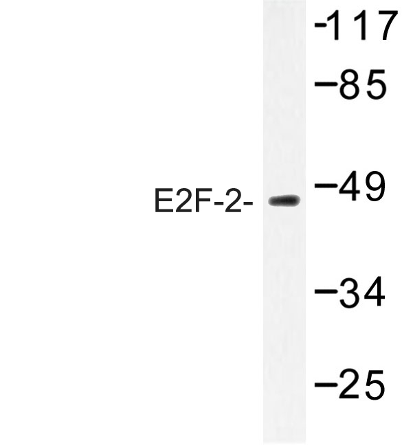E2F2 Antibody - Western blot of E2F-2 (K236) pAb in extracts from HepG2 cells.