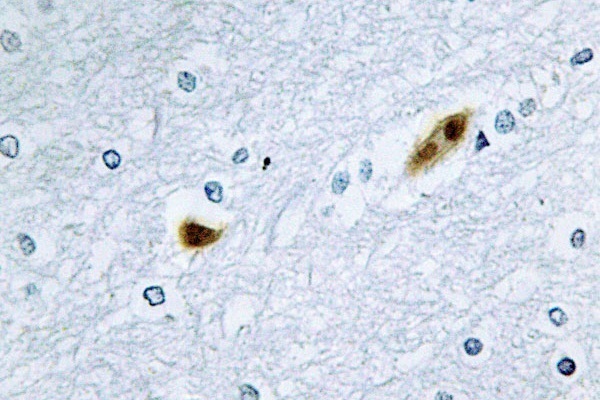 E2F2 Antibody - IHC of E2F-2 (K236) pAb in paraffin-embedded human brain tissue.