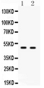 E2F3 Antibody - Western blot - Anti-E2F3 Antibody