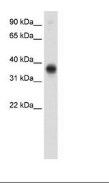 E2F3 Antibody - Fetal Thymus Lysate.  This image was taken for the unconjugated form of this product. Other forms have not been tested.