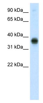 E2F3 Antibody - Western analysis of fetal thymus lysate.  This image was taken for the unconjugated form of this product. Other forms have not been tested.